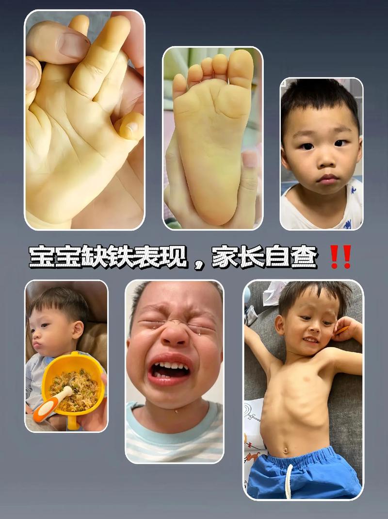 儿童缺什么会浑身没劲？是营养不良还是其他健康问题在作祟？-第2张图片-郑州医学网