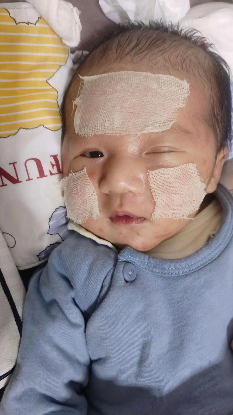 新生儿两侧脸颊不对称-第2张图片-郑州医学网