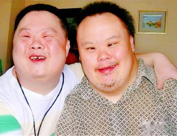 新生儿唐氏综合征筛查怎么做？关键指标和注意事项有哪些？-第2张图片-郑州医学网