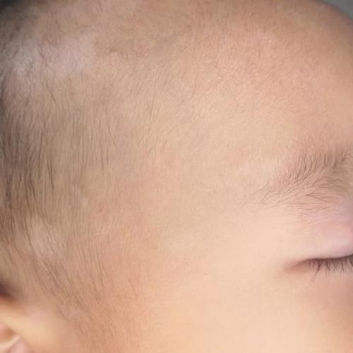 新生儿脑门上有一片白-第3张图片-郑州医学网