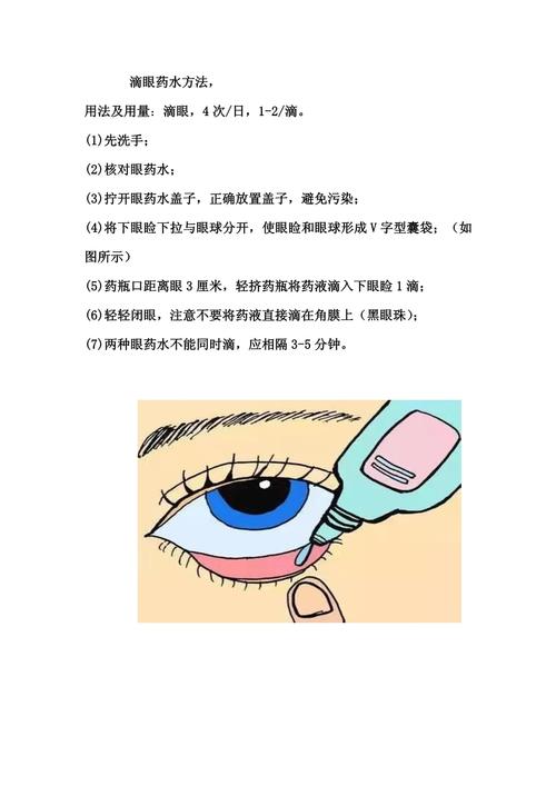 新生儿出生后必须滴眼药水吗？不滴会有感染风险吗？-第1张图片-郑州医学网