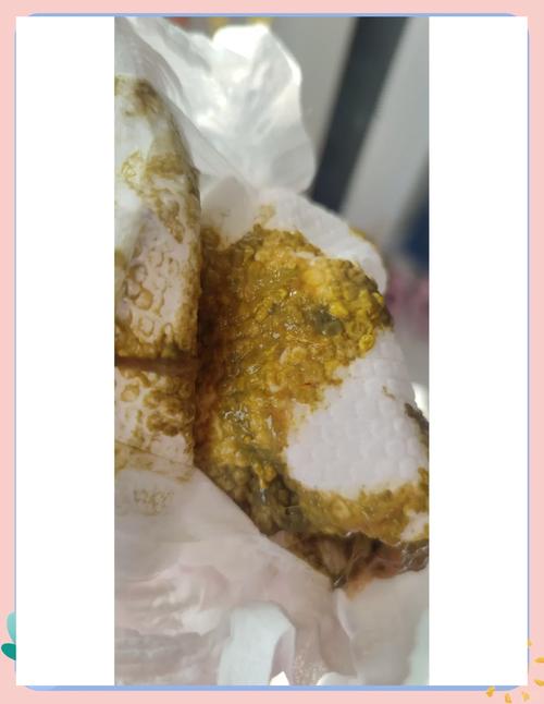 新生儿便便里有红血丝-第3张图片-郑州医学网