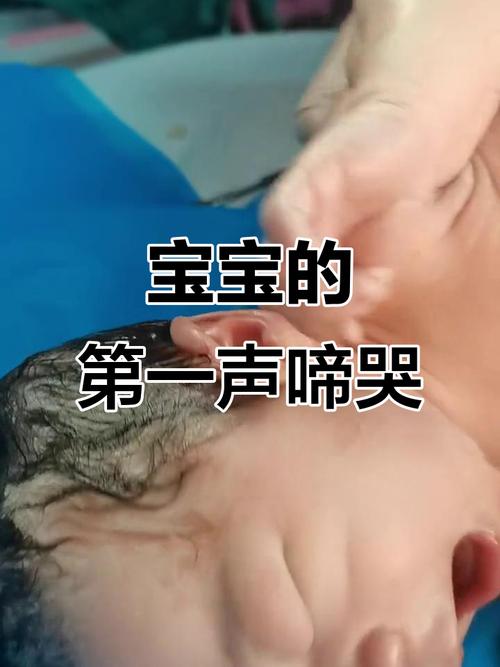 新生儿出生后声音嘶哑，是正常生理现象还是疾病信号？-第1张图片-郑州医学网