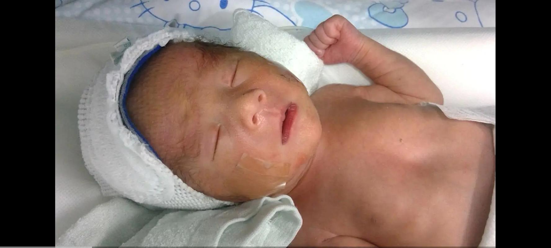 新生儿出生后声音嘶哑，是正常生理现象还是疾病信号？-第3张图片-郑州医学网