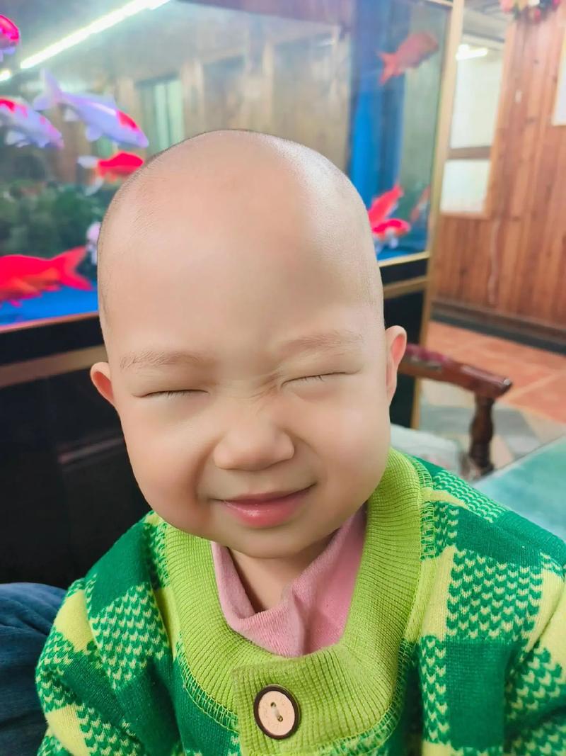 新生儿前额两边没头发-第3张图片-郑州医学网