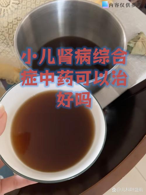 儿童遗传肾炎能治好吗-第1张图片-郑州医学网