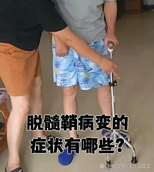儿童脱髓鞘病变有哪些典型症状？家长该如何早期识别与干预？-第3张图片-郑州医学网