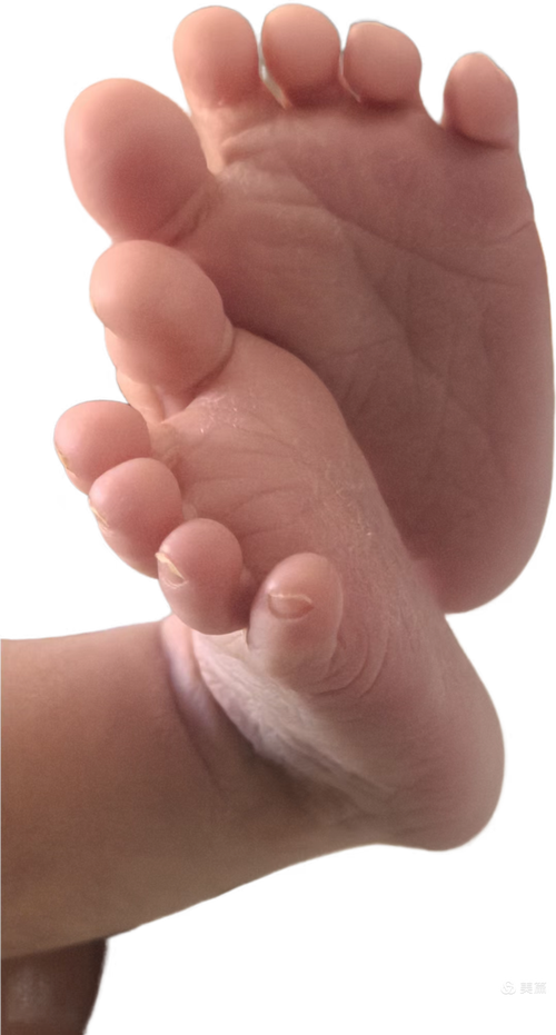 新生儿手指缝里有棉絮-第1张图片-郑州医学网