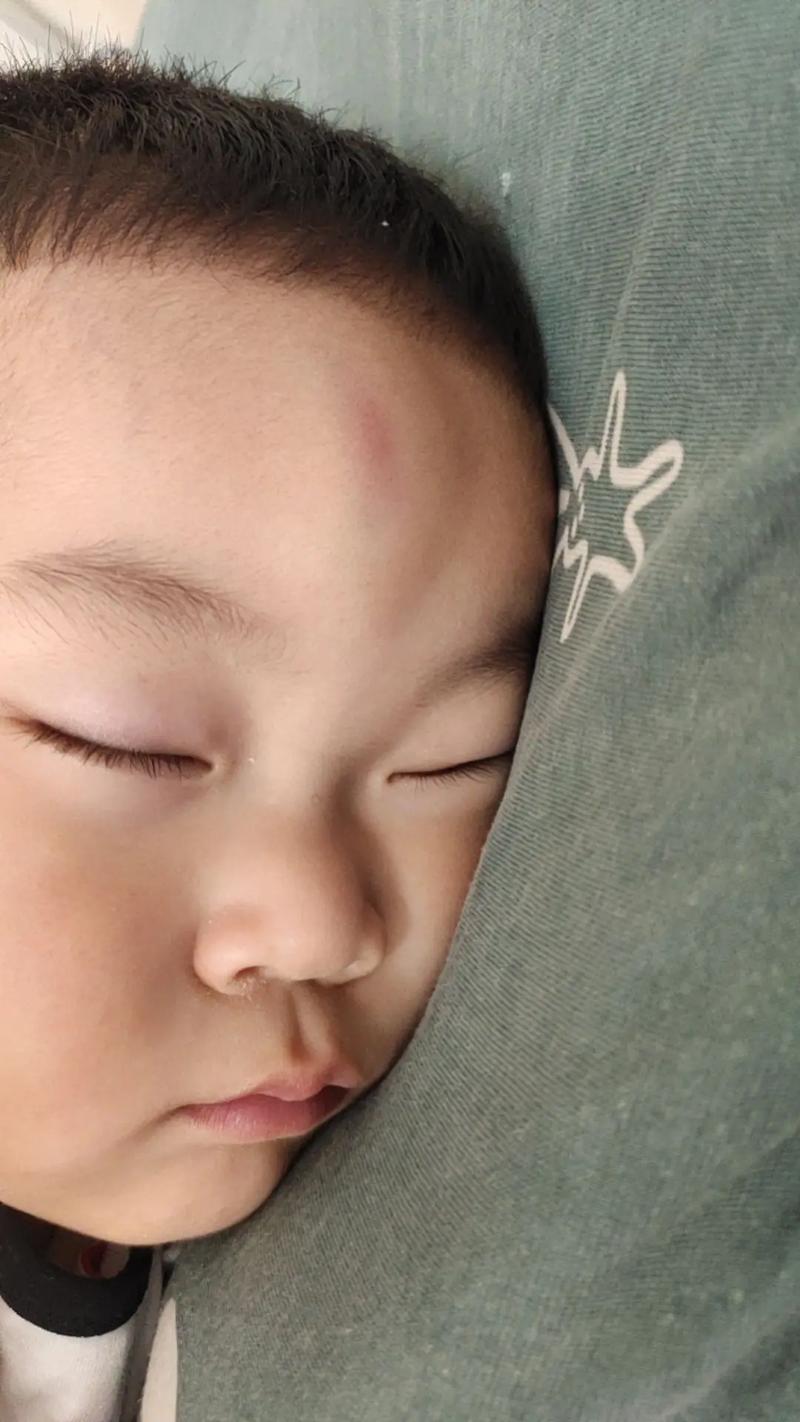 新生儿脑袋被撞了一下-第2张图片-郑州医学网