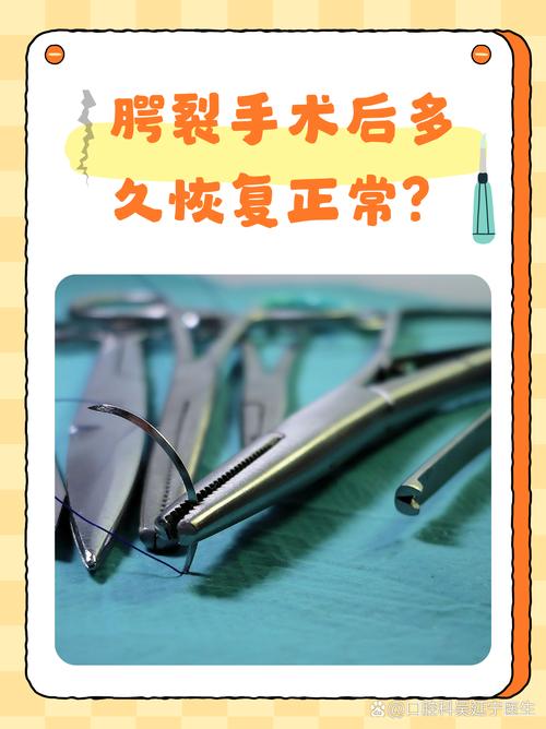 新生儿腭裂多大做手术-第2张图片-郑州医学网