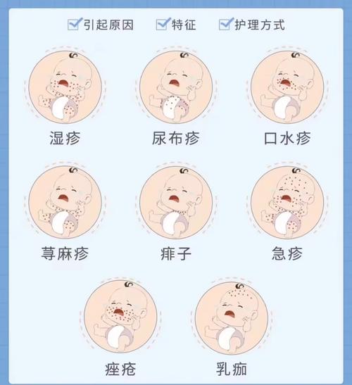 新生儿长热疹什么原因-第1张图片-郑州医学网