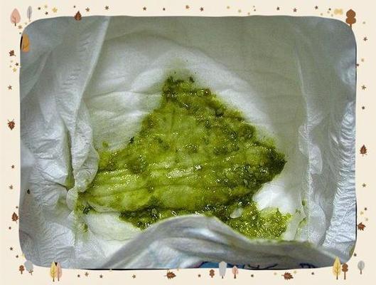 新生儿拉的屎是黑绿色-第2张图片-郑州医学网