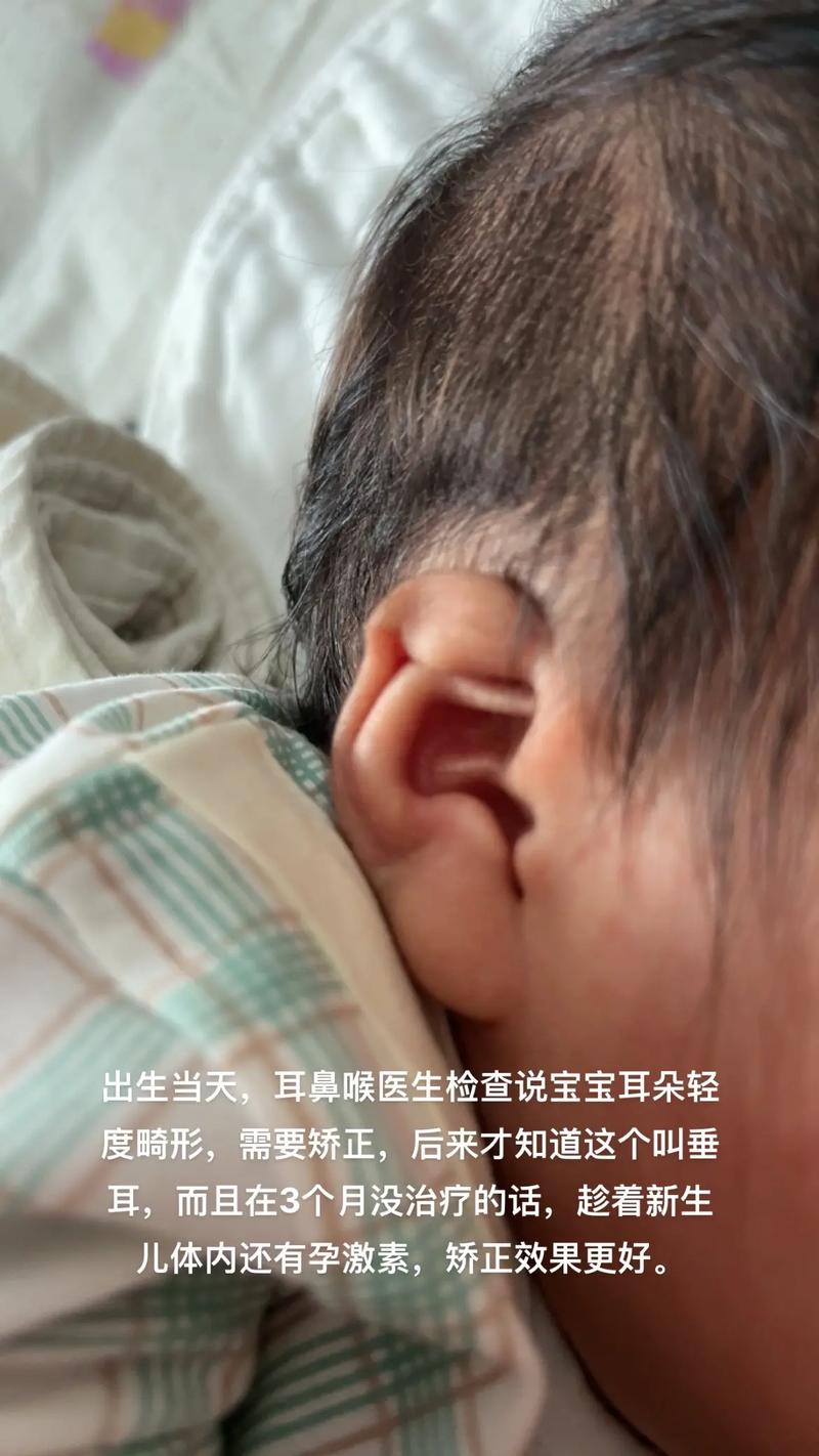 新生儿耳声发射不通过-第1张图片-郑州医学网