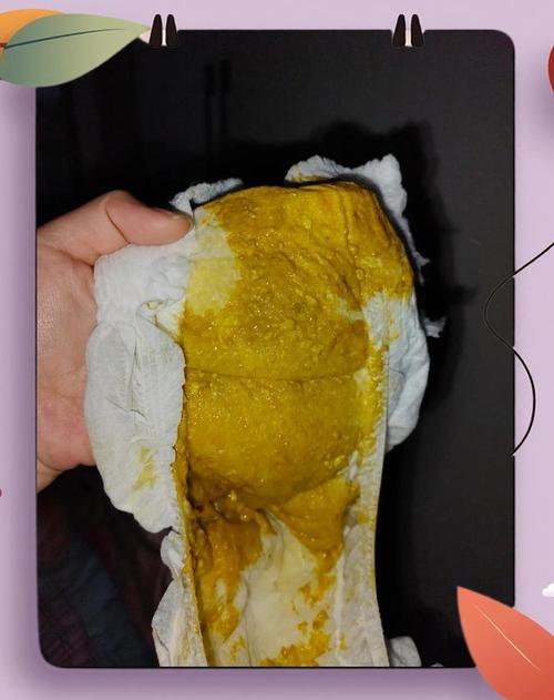 新生儿大便必须用水洗吗？不洗会有哪些影响？正确清洗方法是什么？-第2张图片-郑州医学网