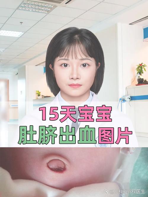 新生儿脐带残端有血是正常现象还是异常信号？需如何紧急处理？-第2张图片-郑州医学网