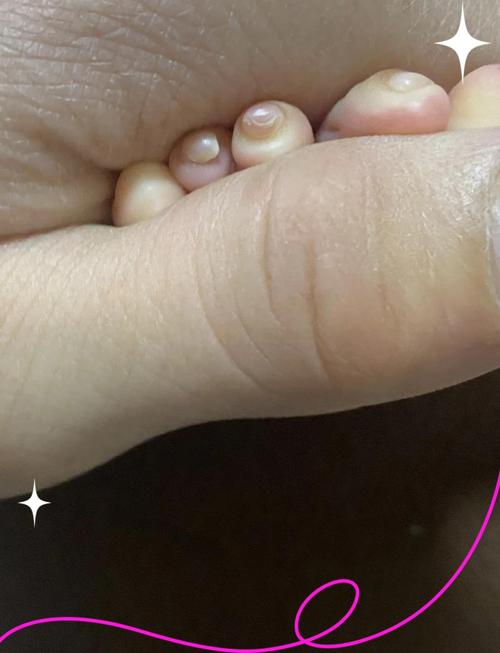 新生儿吃优甲乐不睡觉-第1张图片-郑州医学网