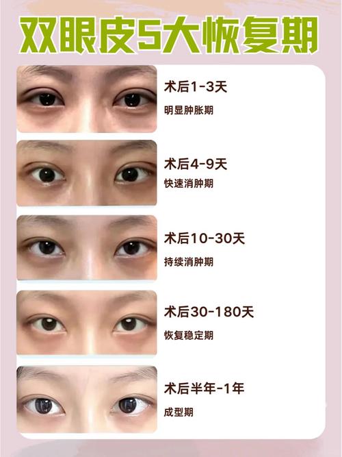 备孕期间能做双眼皮吗？手术风险是否会影响胎儿健康？-第1张图片-郑州医学网