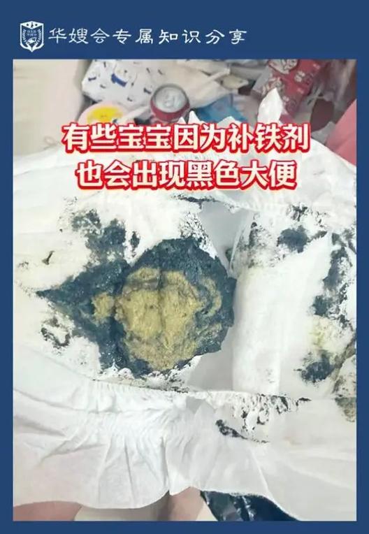 儿童大便发黑怎么回事-第3张图片-郑州医学网 儿童大便发黑怎么回事-第3张图片-郑州医学网