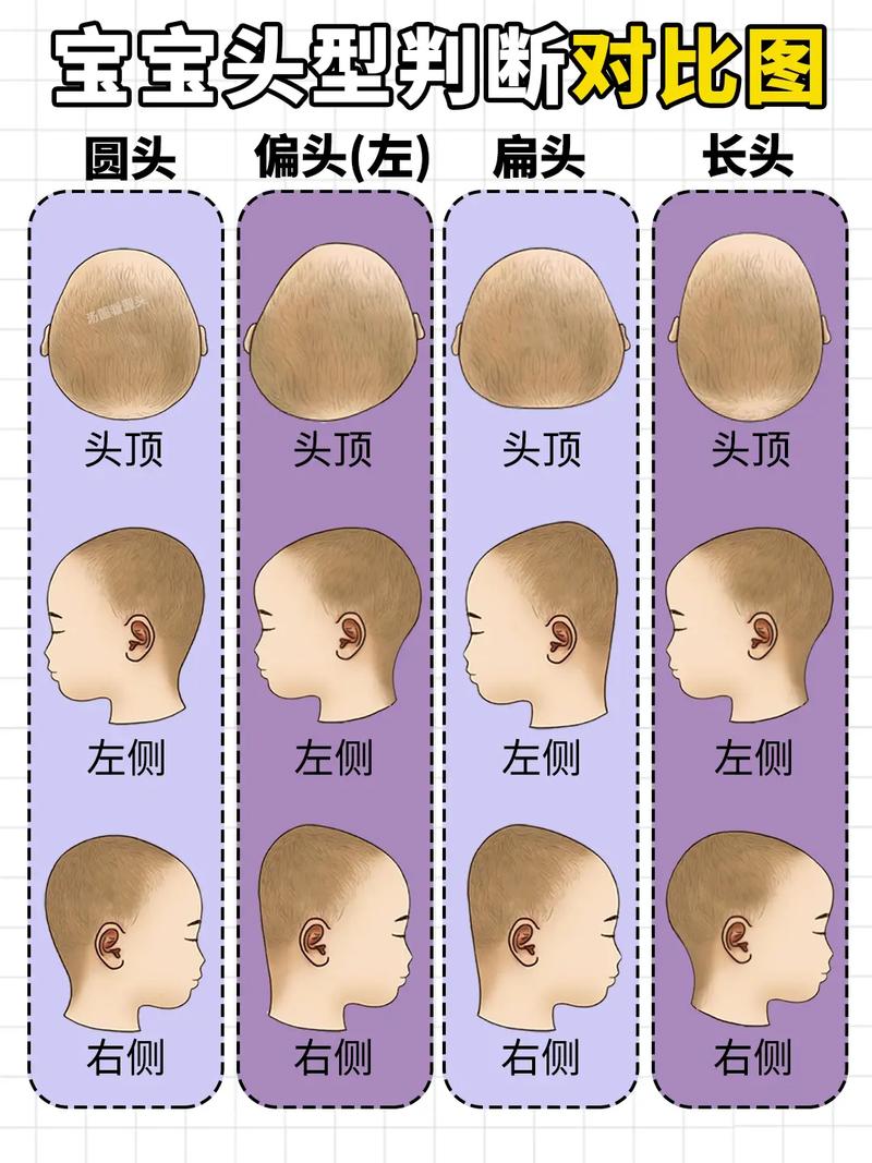 新生儿前几个月睡头型-第3张图片-郑州医学网