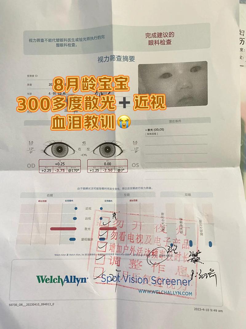儿童散光300度必须立即配镜吗？日常护理和视力训练有用吗？-第2张图片-郑州医学网