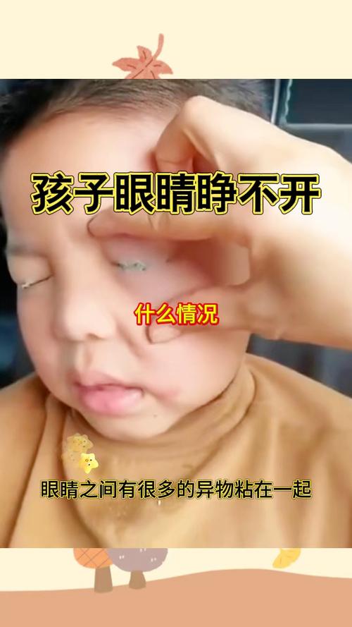 新生儿一只眼睛没睁开-第1张图片-郑州医学网
