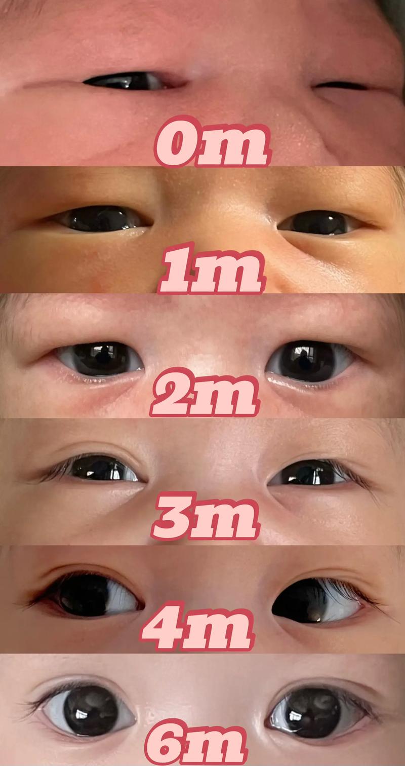 新生儿一只眼睛没睁开-第2张图片-郑州医学网