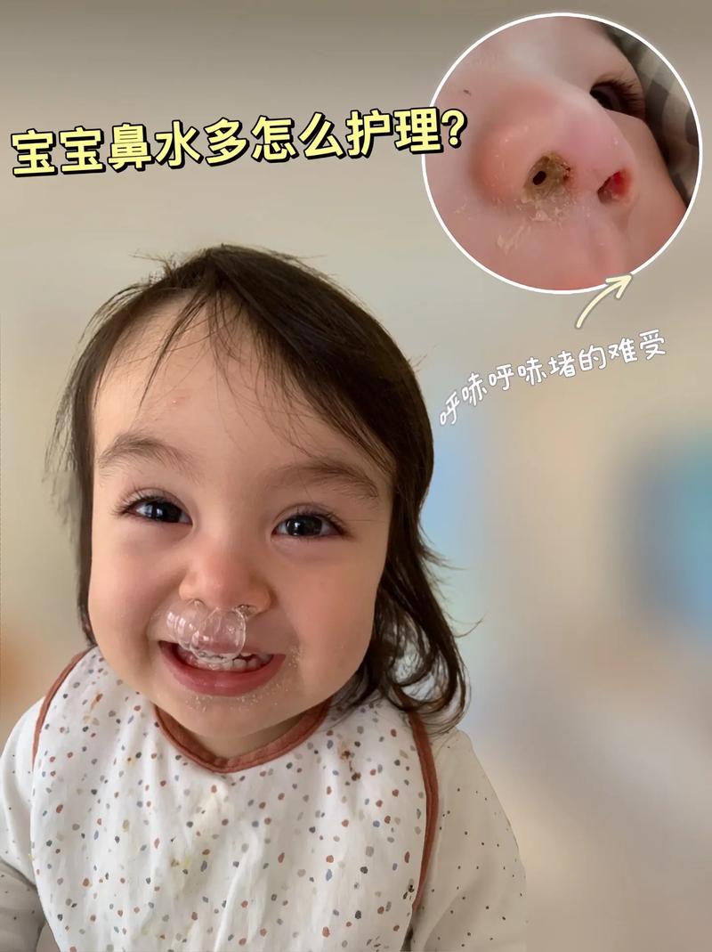 新生儿打喷嚏喷出口水-第1张图片-郑州医学网