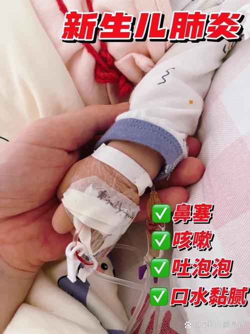 新生儿打喷嚏喷出口水-第2张图片-郑州医学网