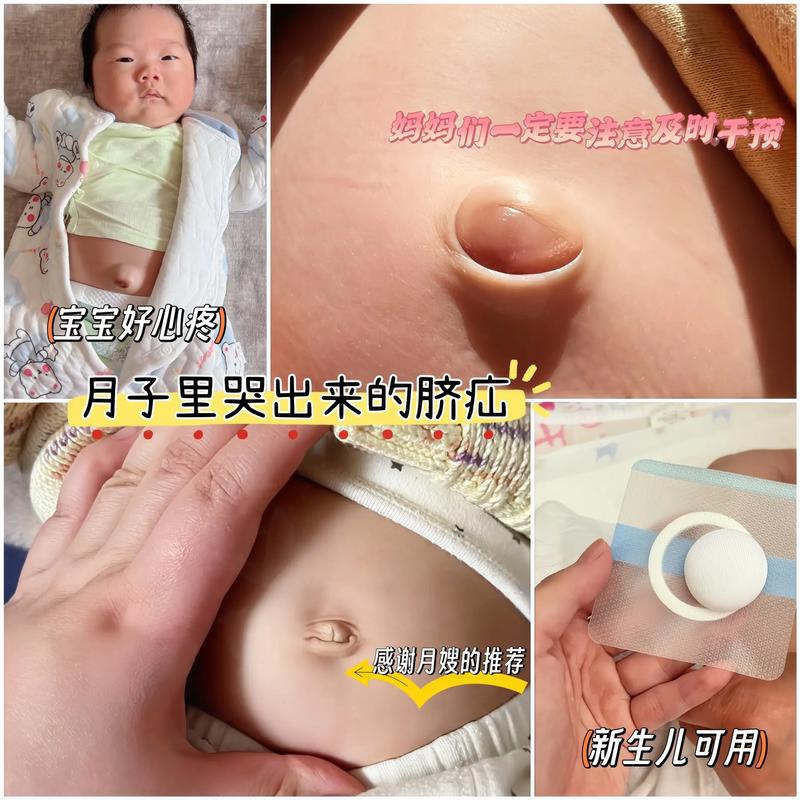 新生儿可以吃脐风散吗-第2张图片-郑州医学网