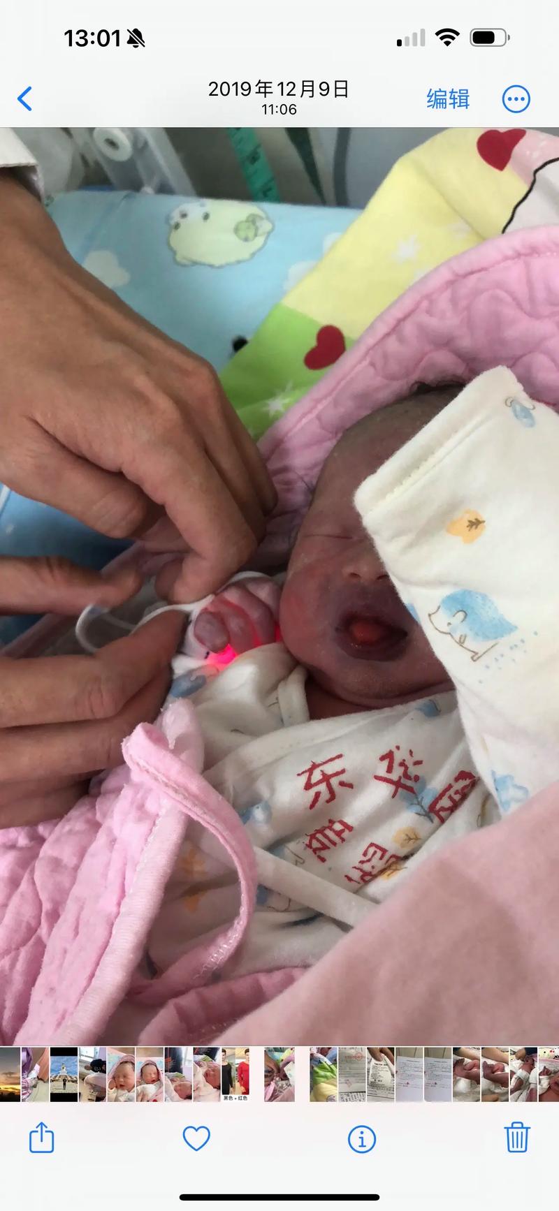 刚出生新生儿舌头发紫是正常现象还是缺氧信号?需要立即就医吗?-第3张图片-郑州医学网 刚出生新生儿舌头发紫是正常现象还是缺氧信号?需要立即就医吗?-第3张图片-郑州医学网