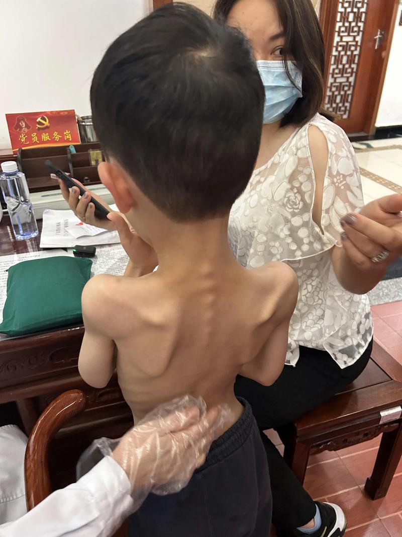 儿童不吃肉是缺乏什么-第2张图片-郑州医学网