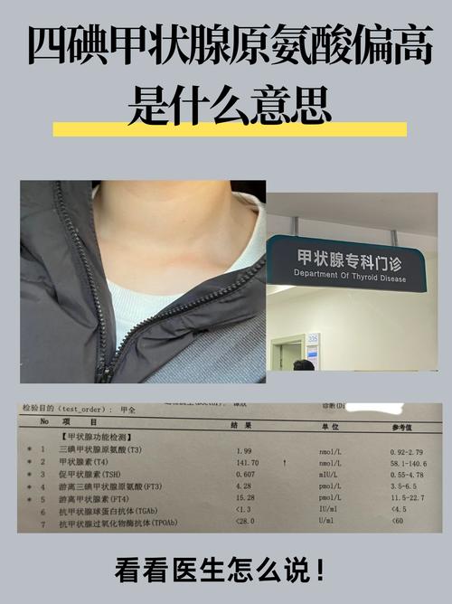 孕期四碘甲状腺素偏高会对胎儿发育有什么影响？-第1张图片-郑州医学网
