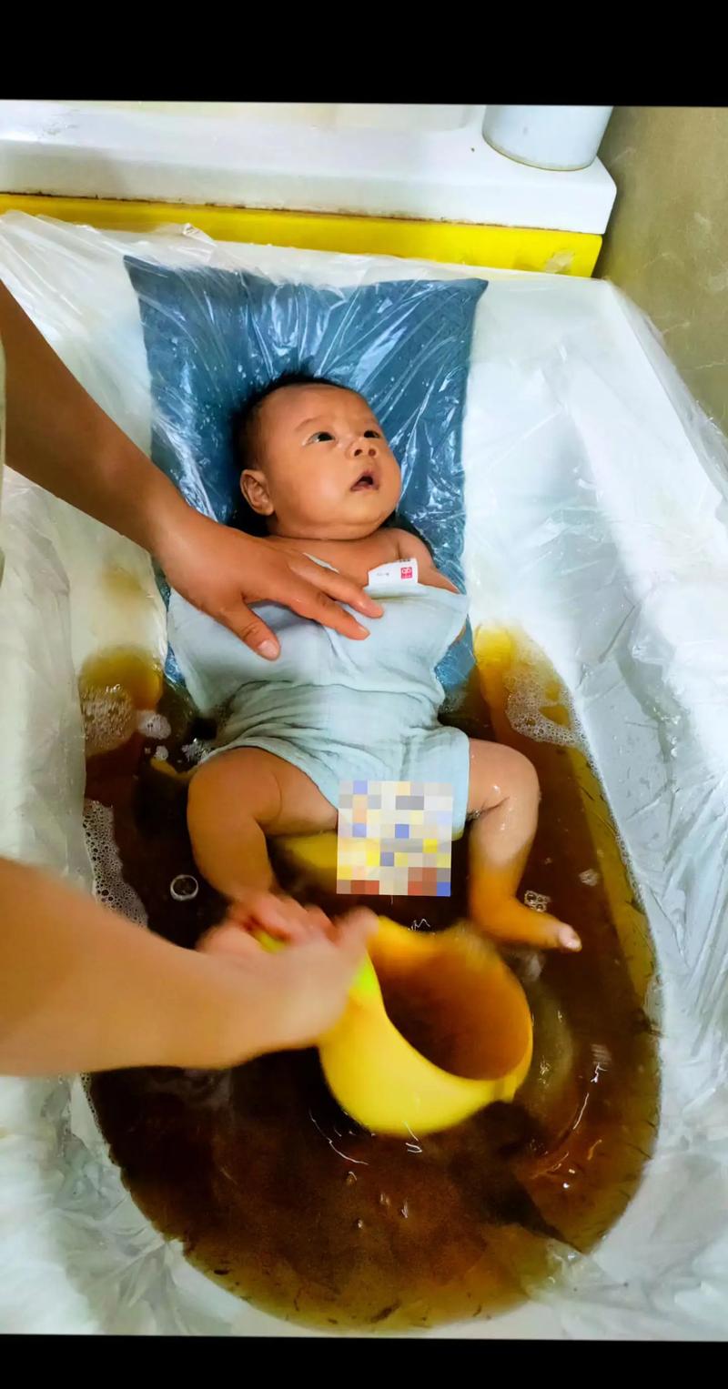 新生儿喝茵栀黄后不拉屎,是药物副作用还是喂养方式有问题?-第2张图片-郑州医学网 新生儿喝茵栀黄后不拉屎,是药物副作用还是喂养方式有问题?-第2张图片-郑州医学网