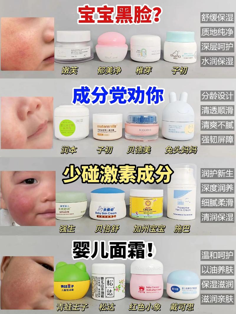新生儿脸上到底能不能抹油?抹什么油才安全?-第1张图片-郑州医学网 新生儿脸上到底能不能抹油?抹什么油才安全?-第1张图片-郑州医学网