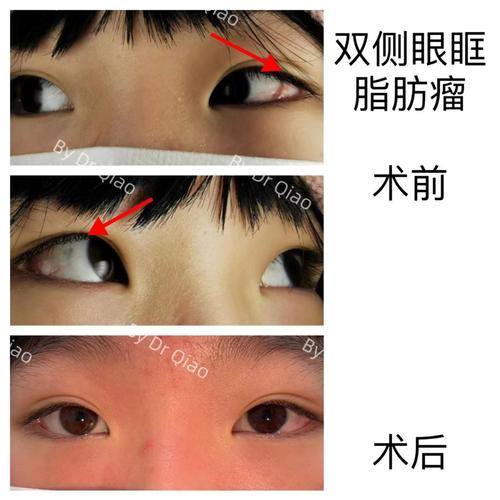 上海儿童医院眼科好吗-第1张图片-郑州医学网