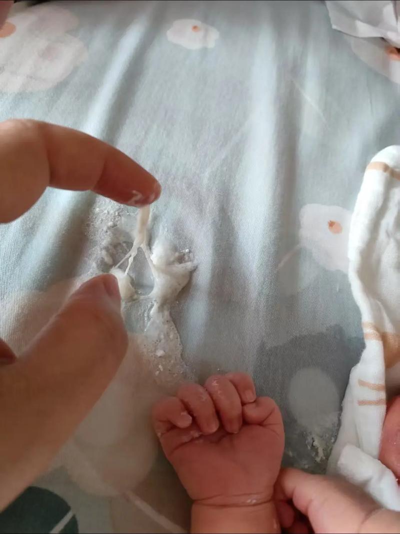 新生儿吐奶出现豆腐渣状是消化问题还是病理性反应?-第1张图片-郑州医学网 新生儿吐奶出现豆腐渣状是消化问题还是病理性反应?-第1张图片-郑州医学网