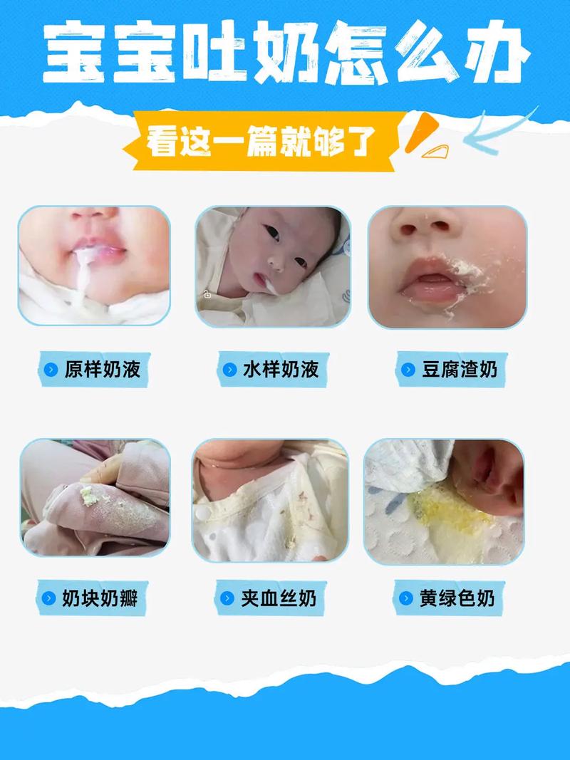 新生儿吐奶出现豆腐渣状是消化问题还是病理性反应?-第3张图片-郑州医学网 新生儿吐奶出现豆腐渣状是消化问题还是病理性反应?-第3张图片-郑州医学网