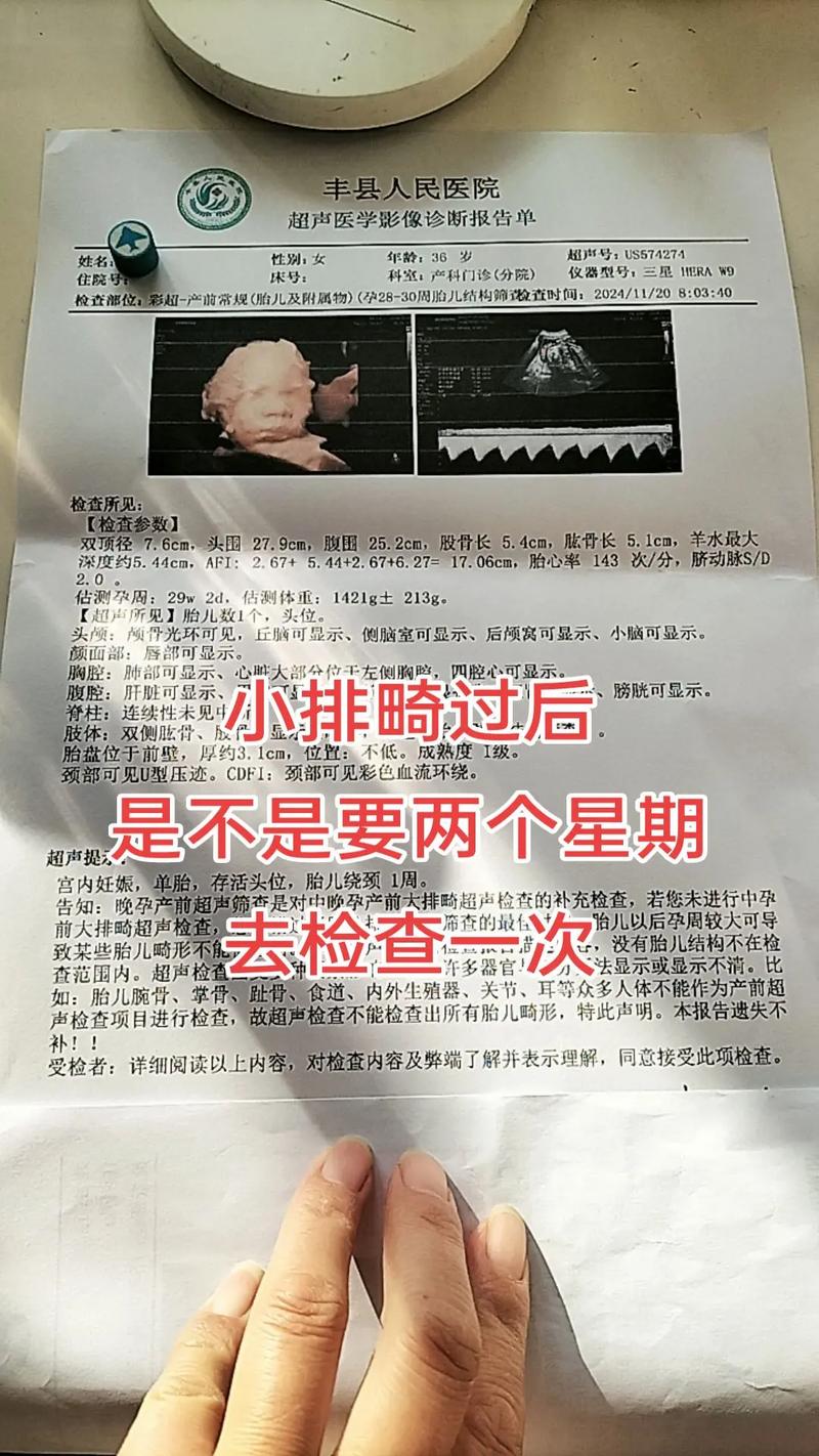 孕期查甲状腺要多少钱-第1张图片-郑州医学网