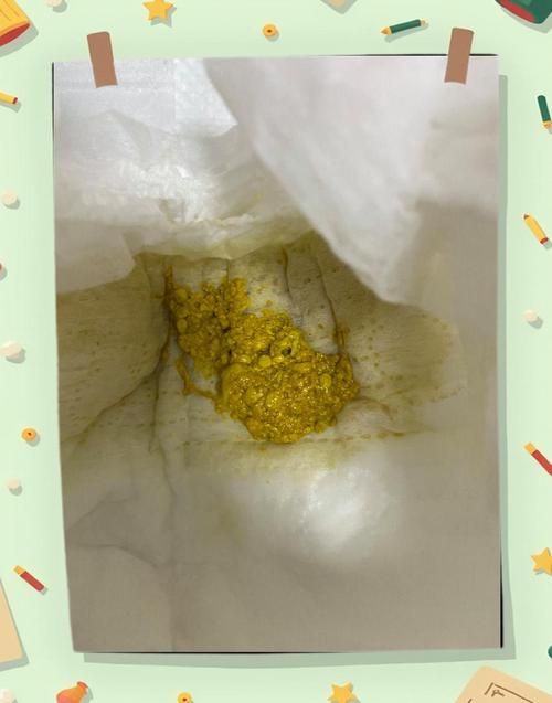 新生儿拉屎有奶瓣酸臭-第1张图片-郑州医学网