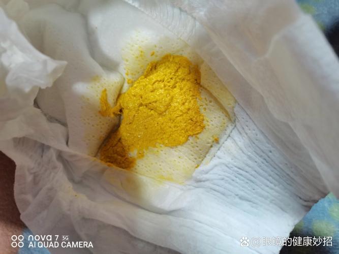 新生儿吃完母乳就拉水是消化不良还是乳糖不耐受？-第1张图片-郑州医学网