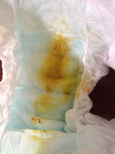 新生儿吃完母乳就拉水是消化不良还是乳糖不耐受？-第3张图片-郑州医学网