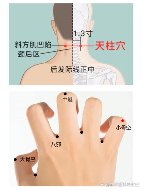 儿童近视艾灸哪里最好-第1张图片-郑州医学网 儿童近视艾灸哪里最好-第1张图片-郑州医学网