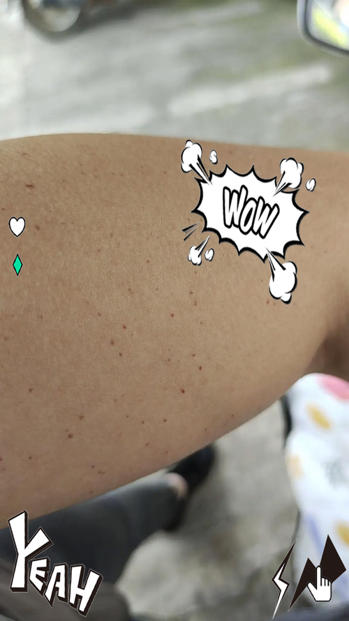 孕期肚皮突然起红点又痒，是皮肤过敏还是妊娠特有疾病？-第1张图片-郑州医学网