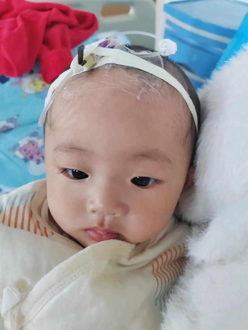 新生儿颅内感染不发烧-第2张图片-郑州医学网