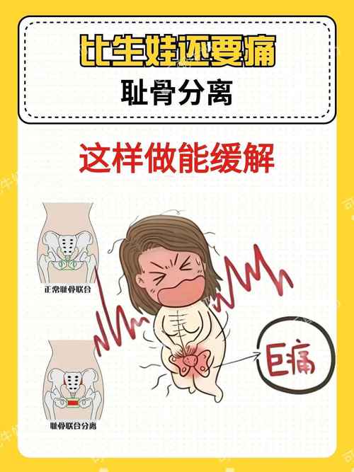 孕期下面骨头疼是正常现象吗？需要怎么缓解才安全？-第1张图片-郑州医学网