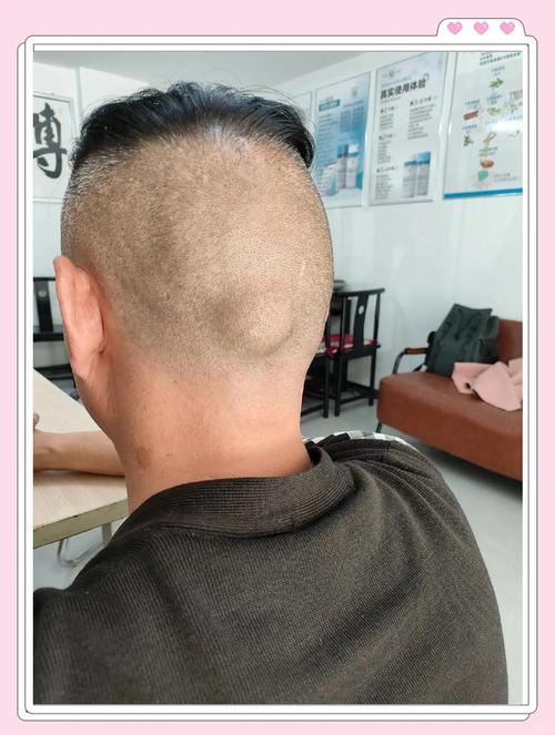 新生儿先天性大脑囊肿是什么原因导致的？会影响宝宝发育吗？-第1张图片-郑州医学网