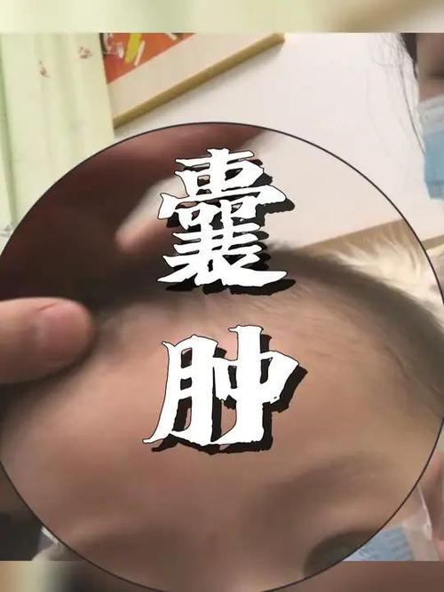 新生儿先天性大脑囊肿是什么原因导致的？会影响宝宝发育吗？-第2张图片-郑州医学网