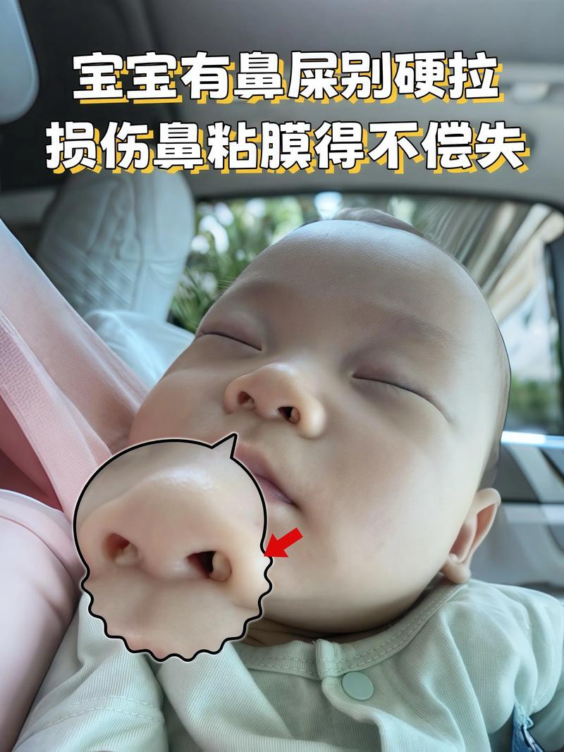 新生儿鼻子里的鼻痂需要清理吗?不清理会影响呼吸吗?-第2张图片-郑州医学网 新生儿鼻子里的鼻痂需要清理吗?不清理会影响呼吸吗?-第2张图片-郑州医学网