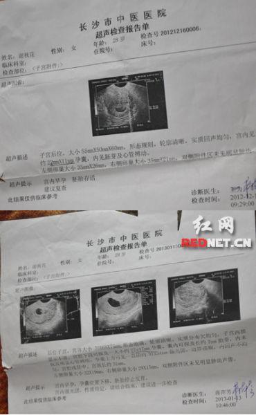 孕期B超检查到底要做几次？不同阶段各有啥重点和注意事项？-第2张图片-郑州医学网