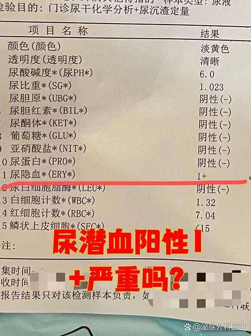 孕期尿常规隐血弱阳性，到底要不要紧？会对胎儿有影响吗？-第1张图片-郑州医学网